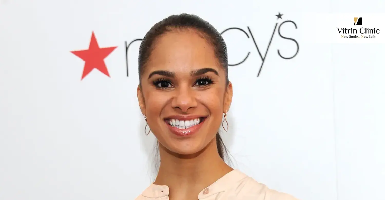Misty Copeland Teeth: Natural Beauty in Motion