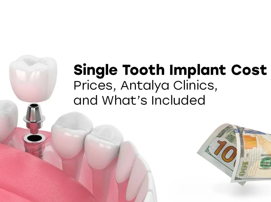 Single Tooth Implant Cost Turkey