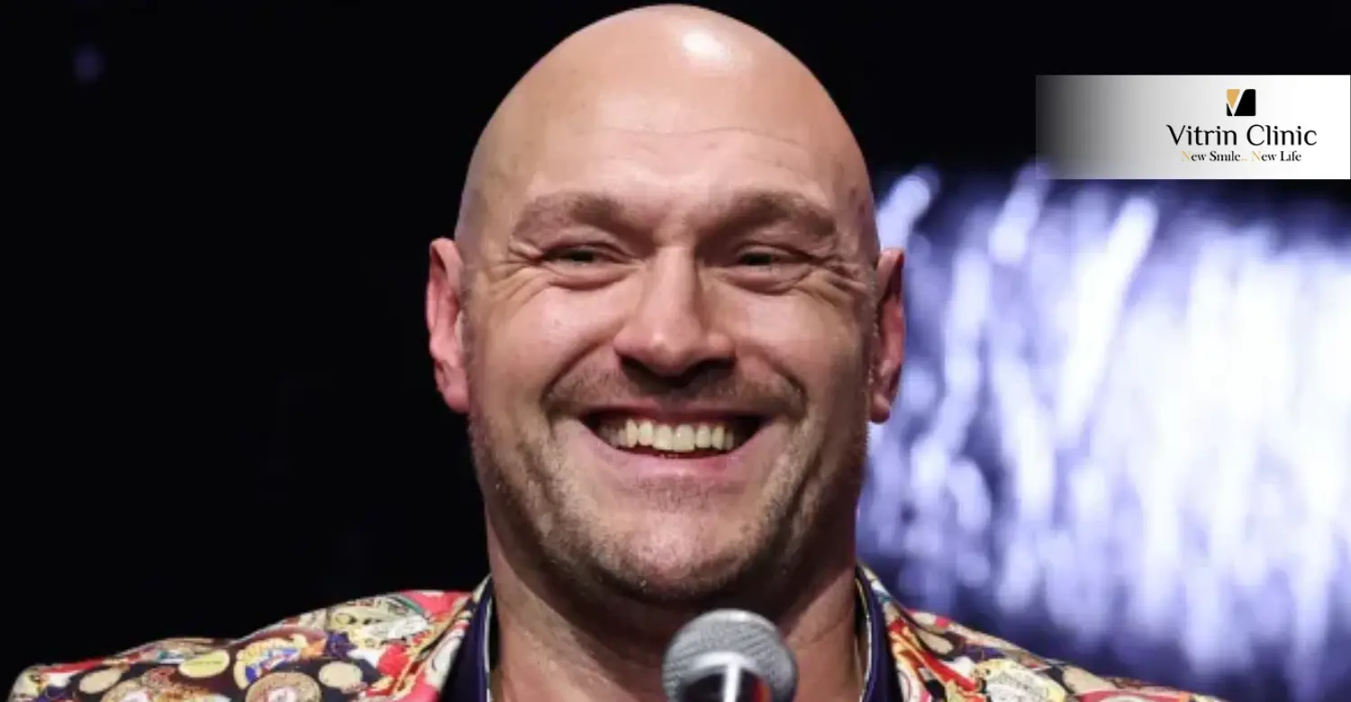 Sorriso de Tyson Fury