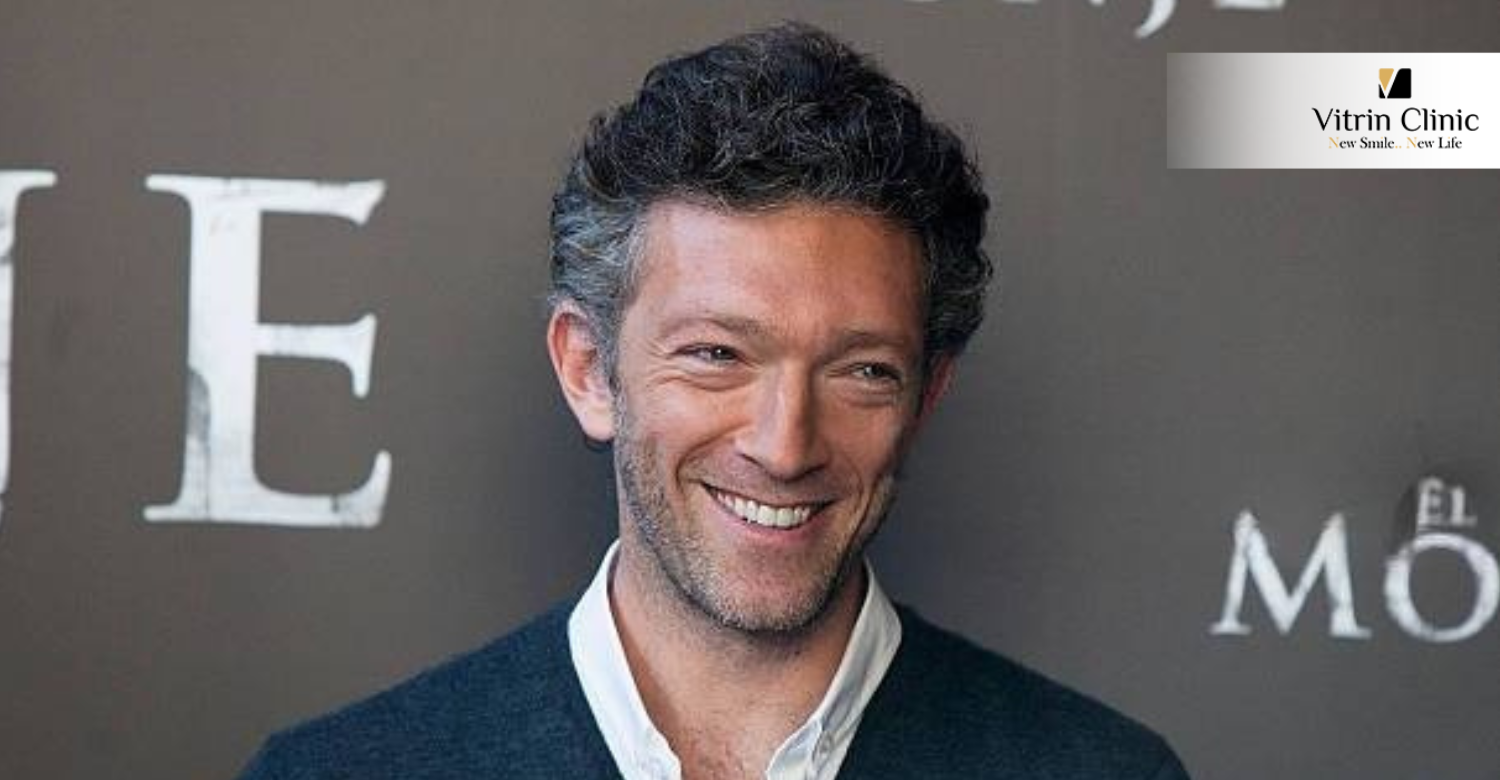 vincent cassel dents