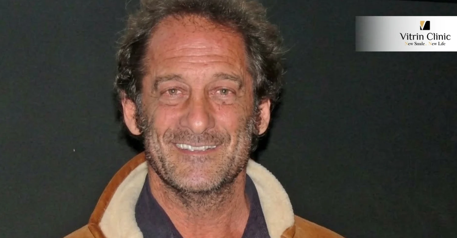 Vincent Lindon dents