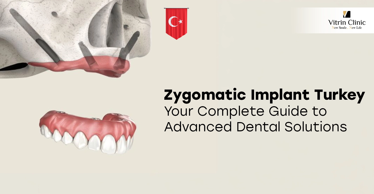 Zygomatic Implant Turkey