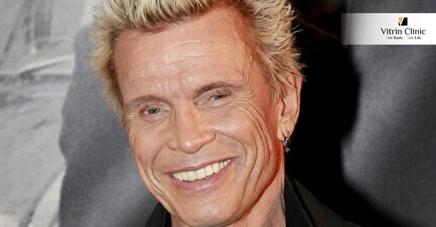 The Evolution of the Billy Idol Smile