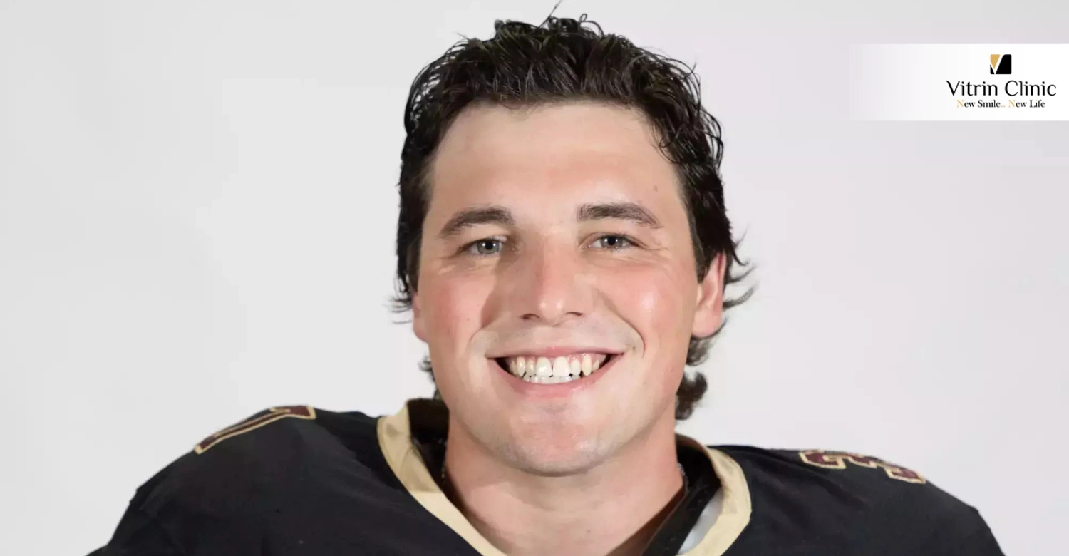Brendan Franke Smile