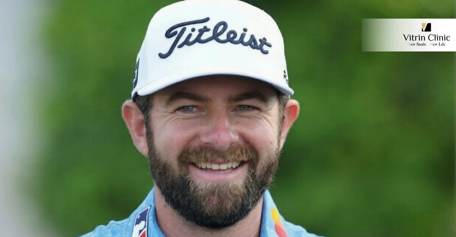 How Did Cameron Young Get His Famous Smile?