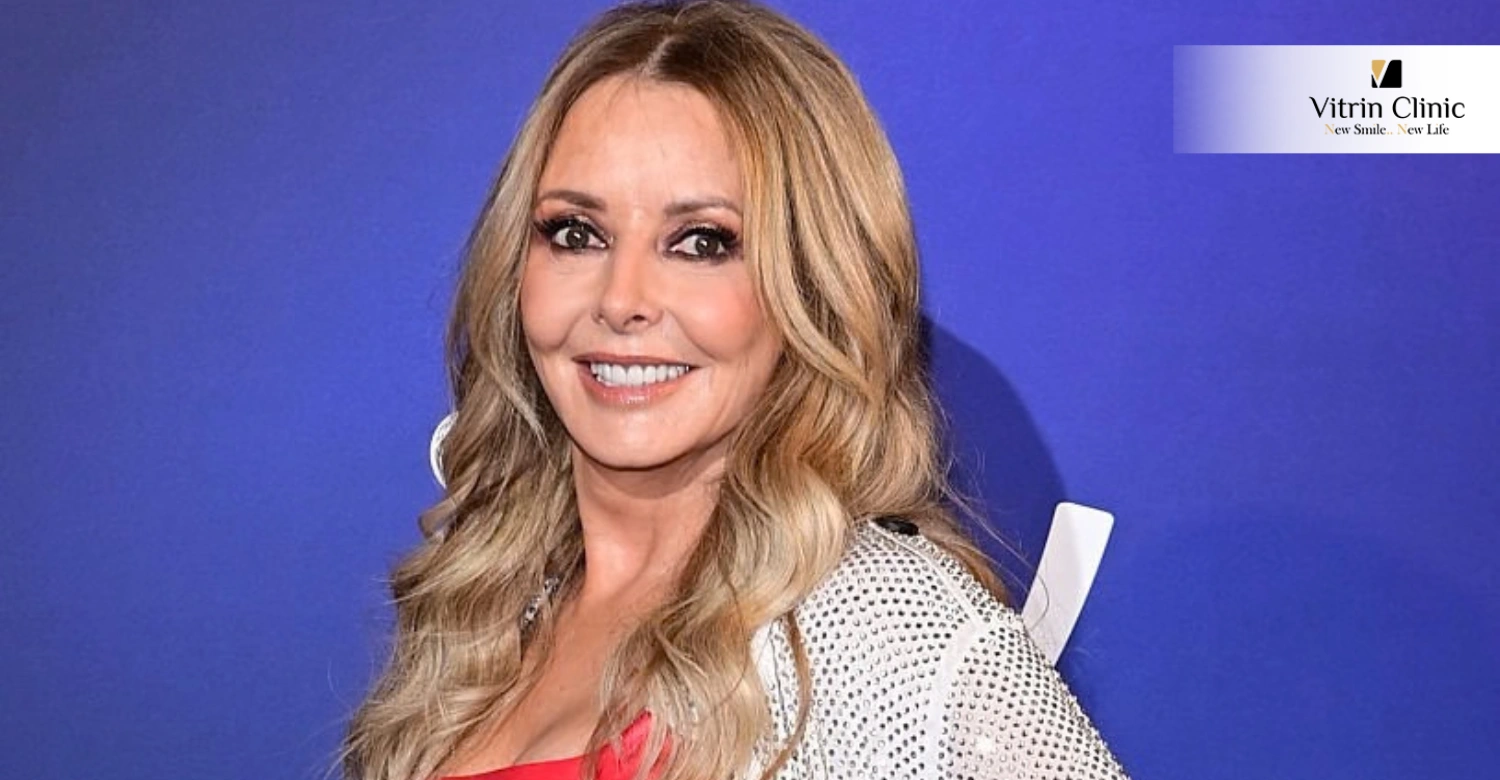 Carol Vorderman Smile Transformation