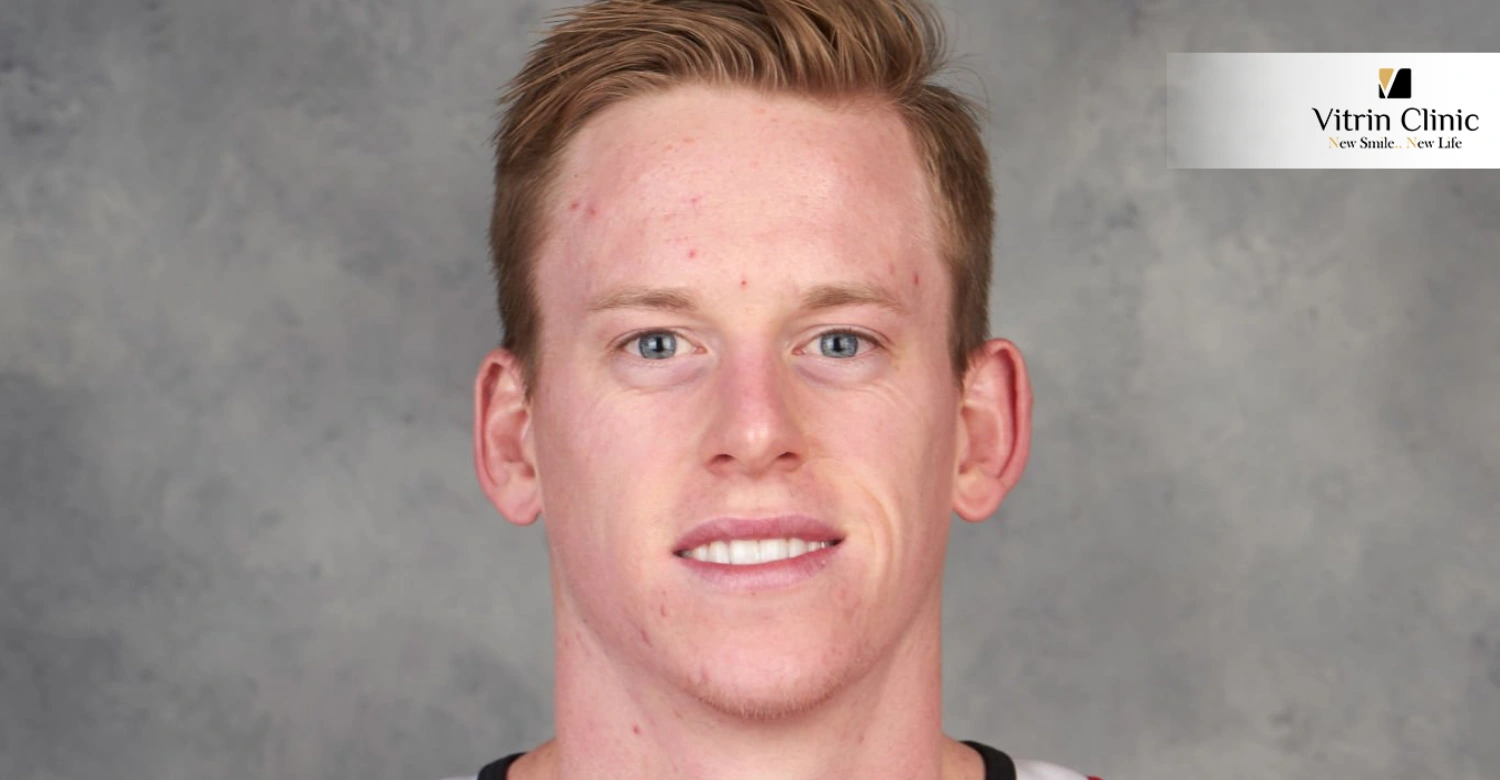 Connor Murphy Smile