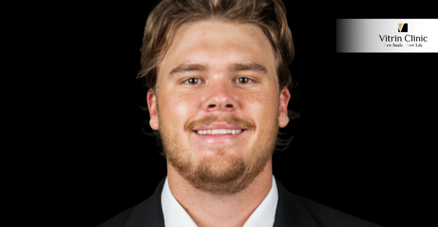 Carter Davis Smile