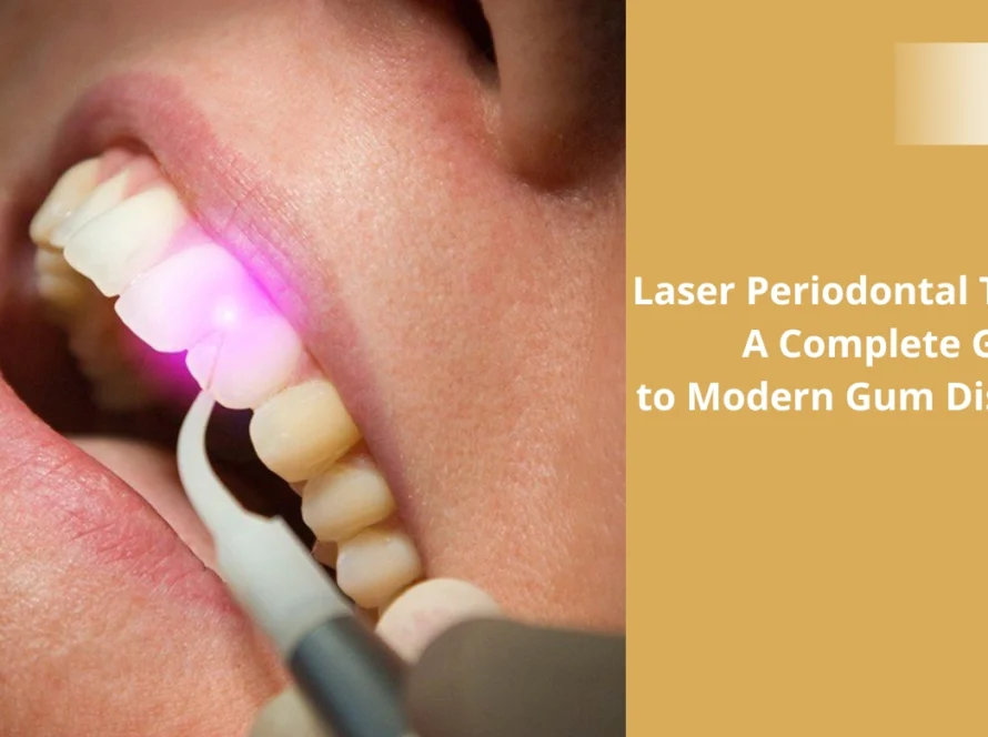 Laser Periodontal Treatment