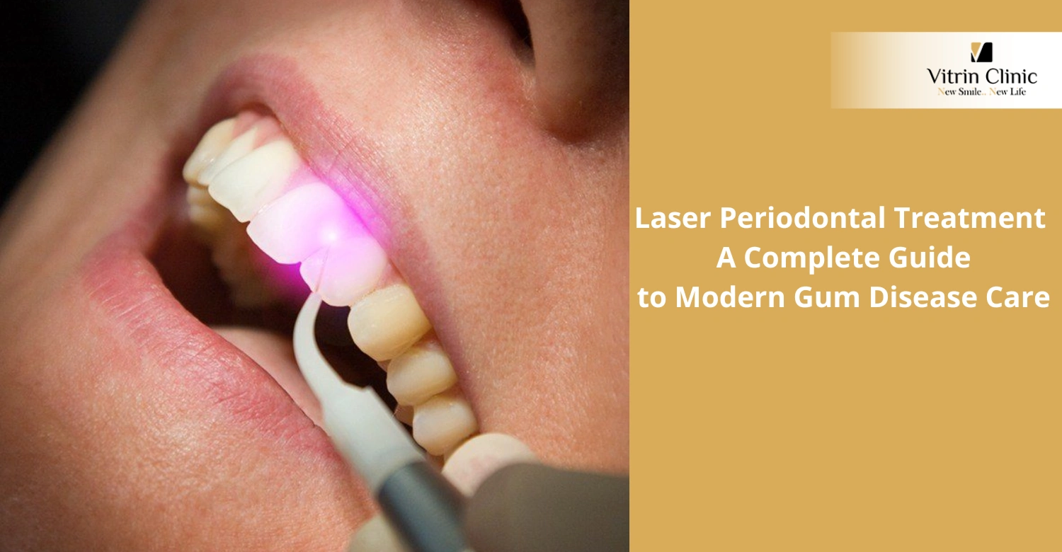 Laser Periodontal Treatment