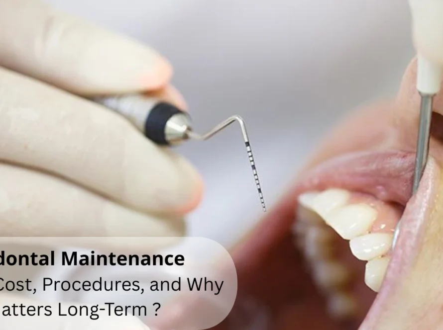 Periodontal Maintenance