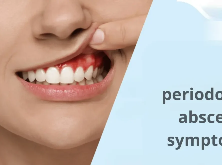 Periodontal Abscess Symptoms