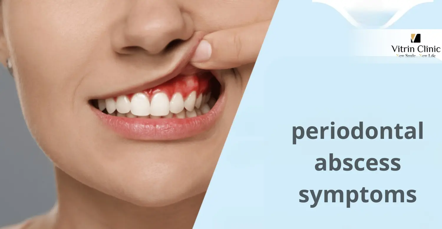 Periodontal Abscess Symptoms