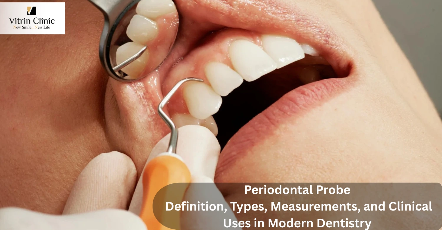 Periodontal Probe
