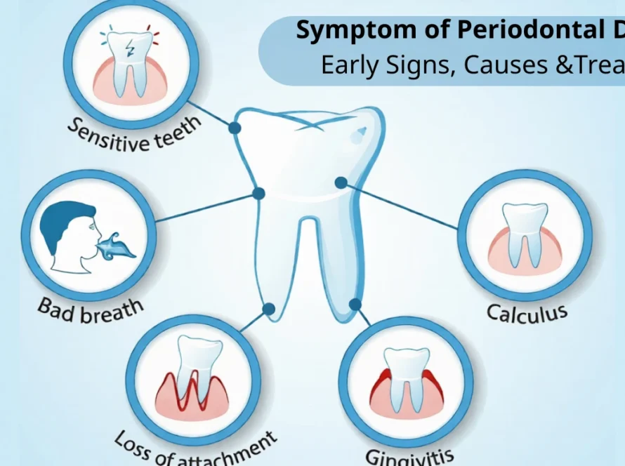 Symptom of Periodontal Disease